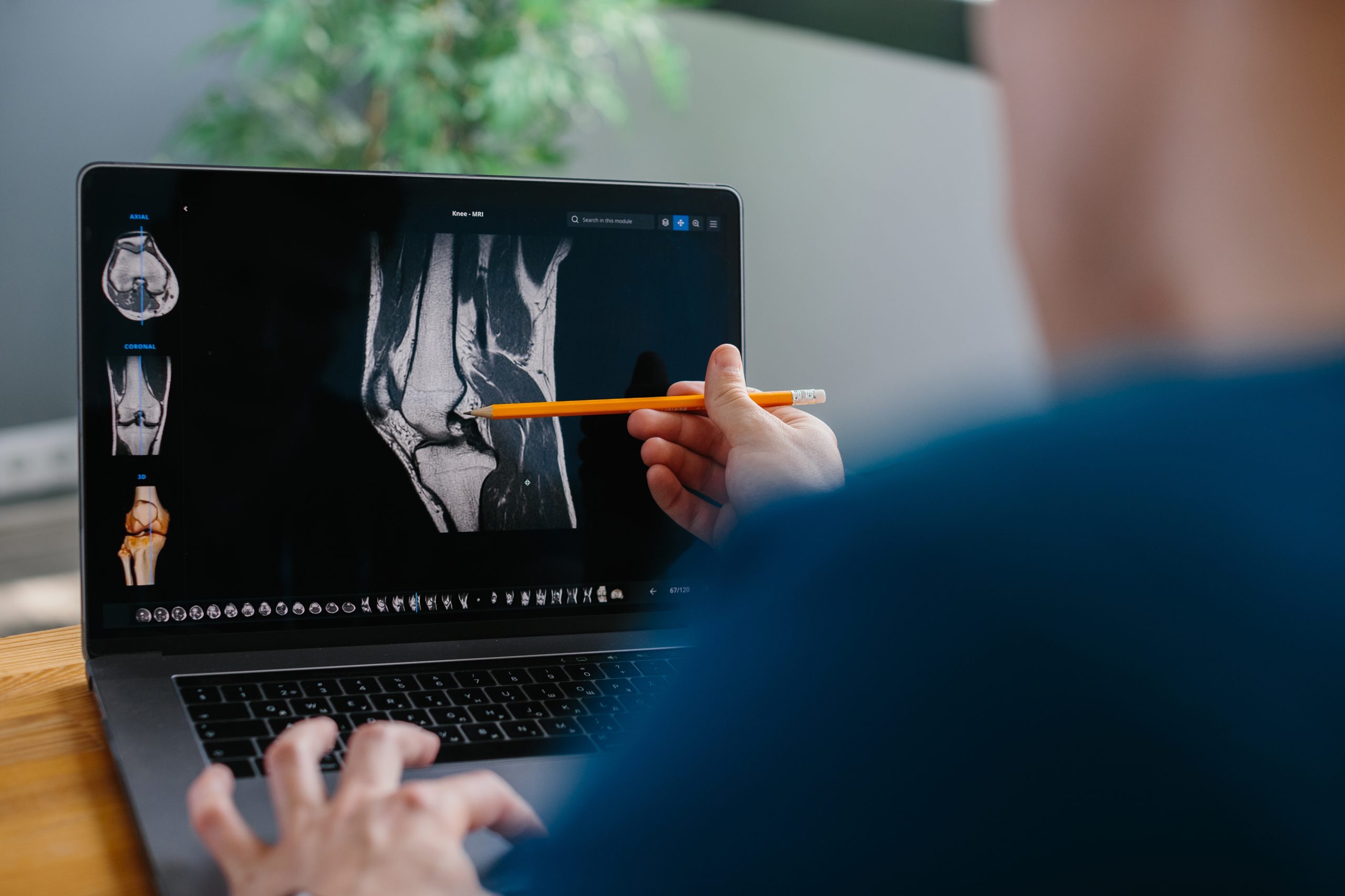Professional looks over the results of a knee MRI scan on a laptop.